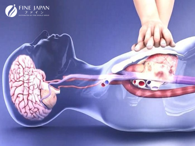 Dấu Hiệu Đột Quỵ Trước Một Tuần