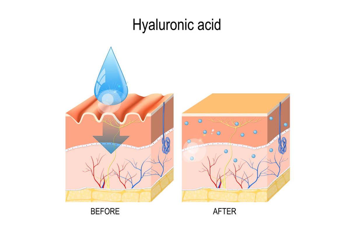 Hyaluronic Acid có tác dụng gì với làn da?