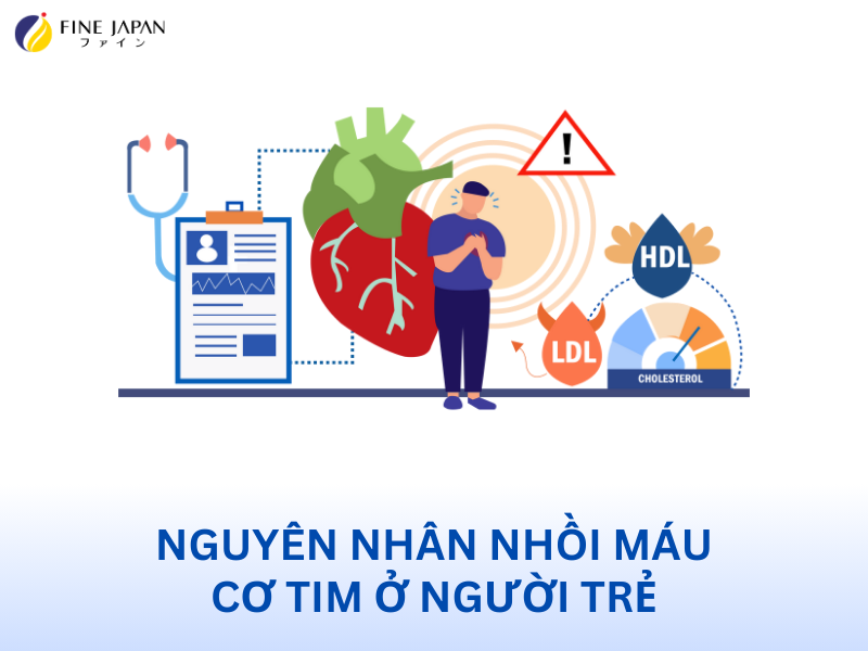 Nguyên Nhân Nhồi Máu Cơ Tim Ở Người Trẻ