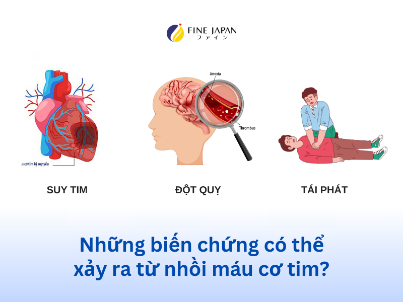 Nhồi máu cơ tim có chữa khỏi không? Nhồi máu cơ tim có chữa khỏi không?