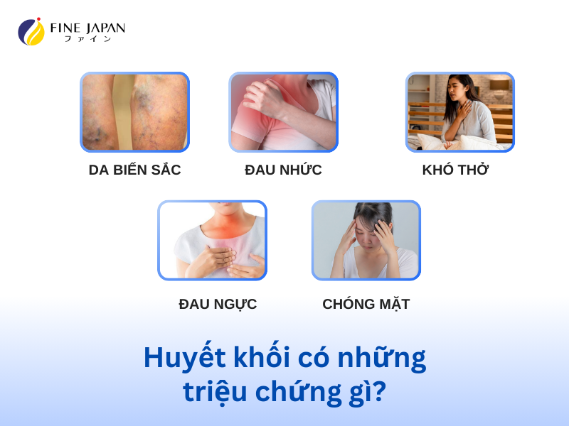 Cục máu đông: nguyên nhân, triệu chứng và cách ngăn ngừa