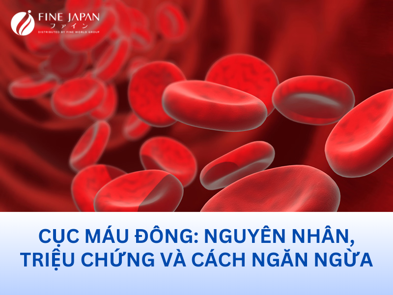 Cục máu đông: nguyên nhân, triệu chứng và cách ngăn ngừa