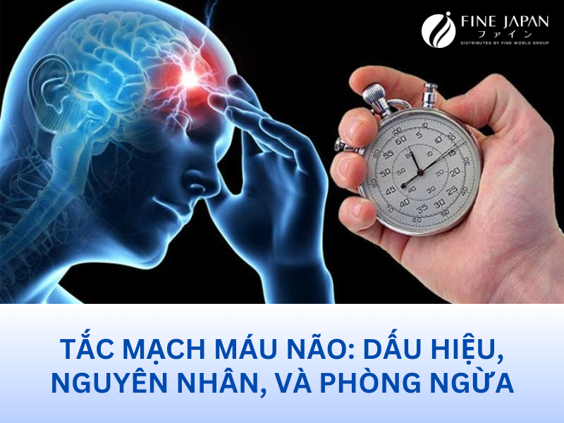 Tắc mạch máu não: Dấu hiệu, nguyên nhân, và phòng ngừa