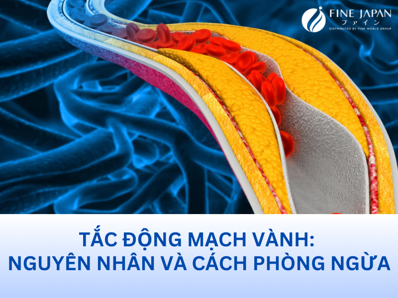 Tắc động mạch vành: Nguyên nhân và cách phòng ngừa
