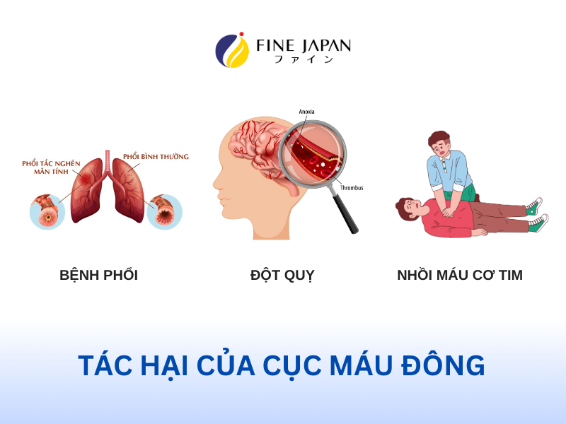 Thực Phẩm Làm Tan Cục Máu Đông Ngăn Ngừa Đột Quỵ