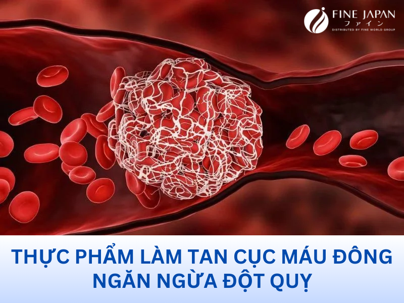 Thực Phẩm Làm Tan Cục Máu Đông Ngăn Ngừa Đột Quỵ