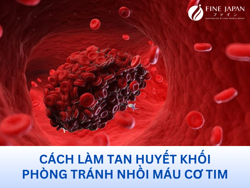 Cách Làm Tan Huyết Khối Phòng Tránh Nhồi Máu Cơ Tim