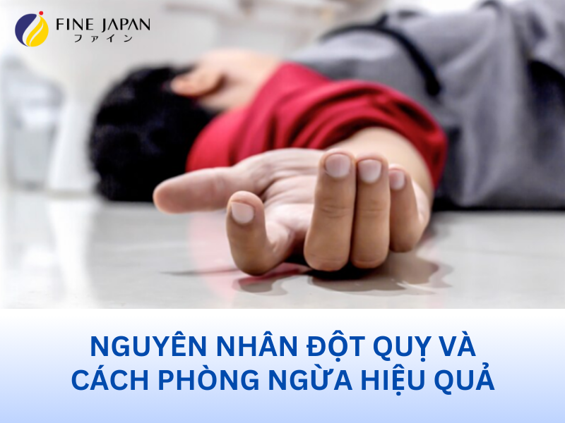 Nguyên Nhân Đột Quỵ Và Cách Phòng Ngừa Hiệu Quả