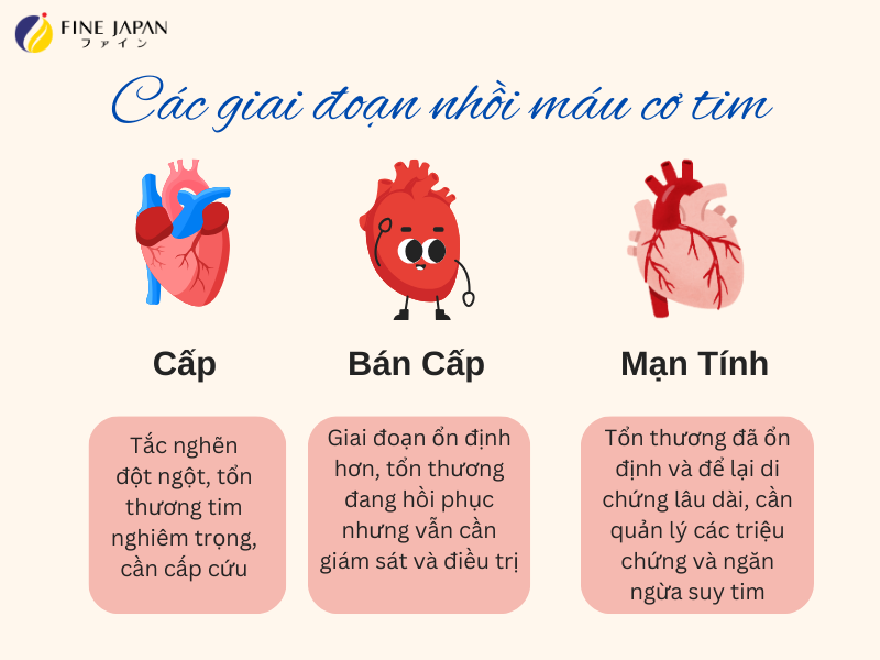 Nhồi Máu Cơ Tim Cấp: Dấu Hiệu và Cách Phòng Ngừa