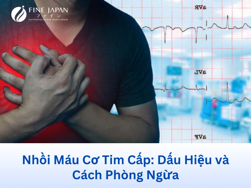 Nhồi Máu Cơ Tim Cấp: Dấu Hiệu và Cách Phòng Ngừa