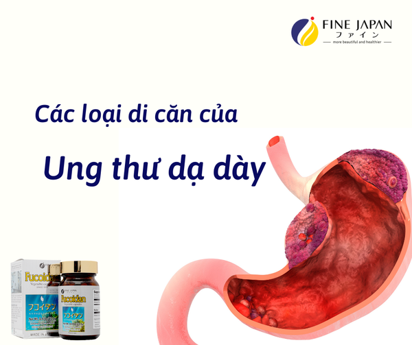 Ung thư dạ dày di căn