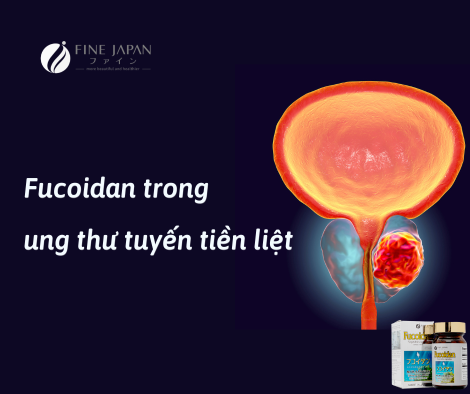 Tác dụng không ngờ của Fucoidan trong ngăn ngừa và hỗ trợ điều trị ung thư tuyến tiền liệt